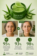 EyeLift Pro™ - Tecnologia regeneradora contra bolsas e olheiras