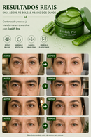 EyeLift Pro™ - Tecnologia regeneradora contra bolsas e olheiras