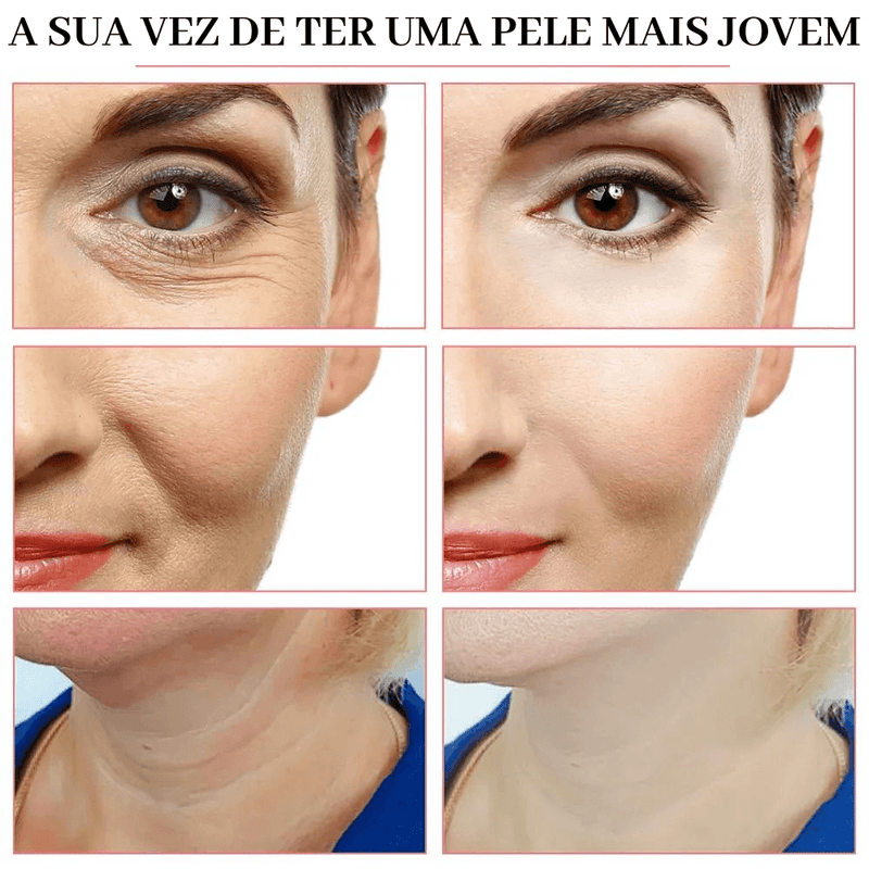 Estimulador Lifting Face Pro Max - 5 EM 1 - ORIGINAL - dup-store